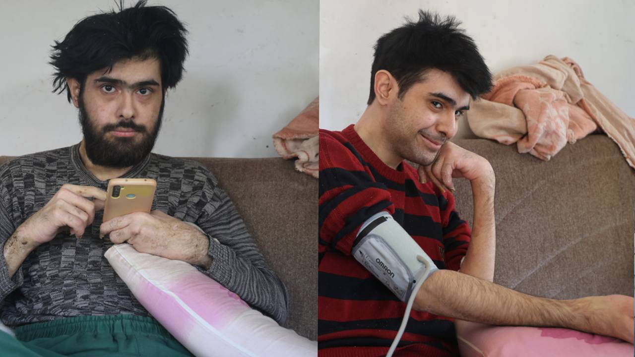 3 yil sonra dus alip tiras olmustu barisa teshis konuldu n6pCi73M.jpg